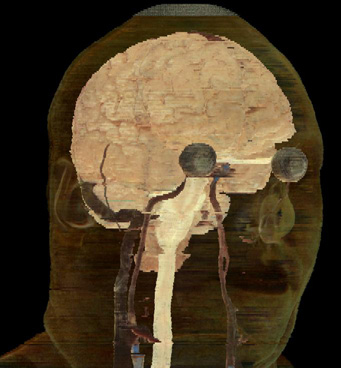 Figure of brain