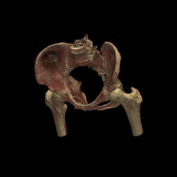 Figure of pelvis